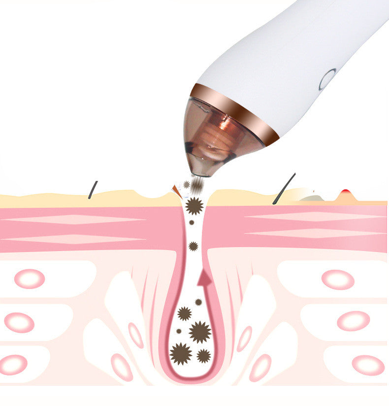 4-in-1 Body Guasha Cupping Blackhead Remover Machine Facial Pore Deep