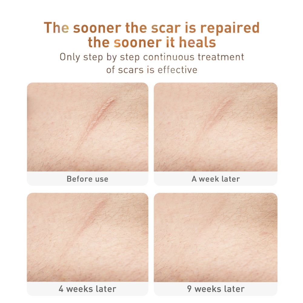 Traditional Chinese Medicine Scar Removal Cream Care Skin Products