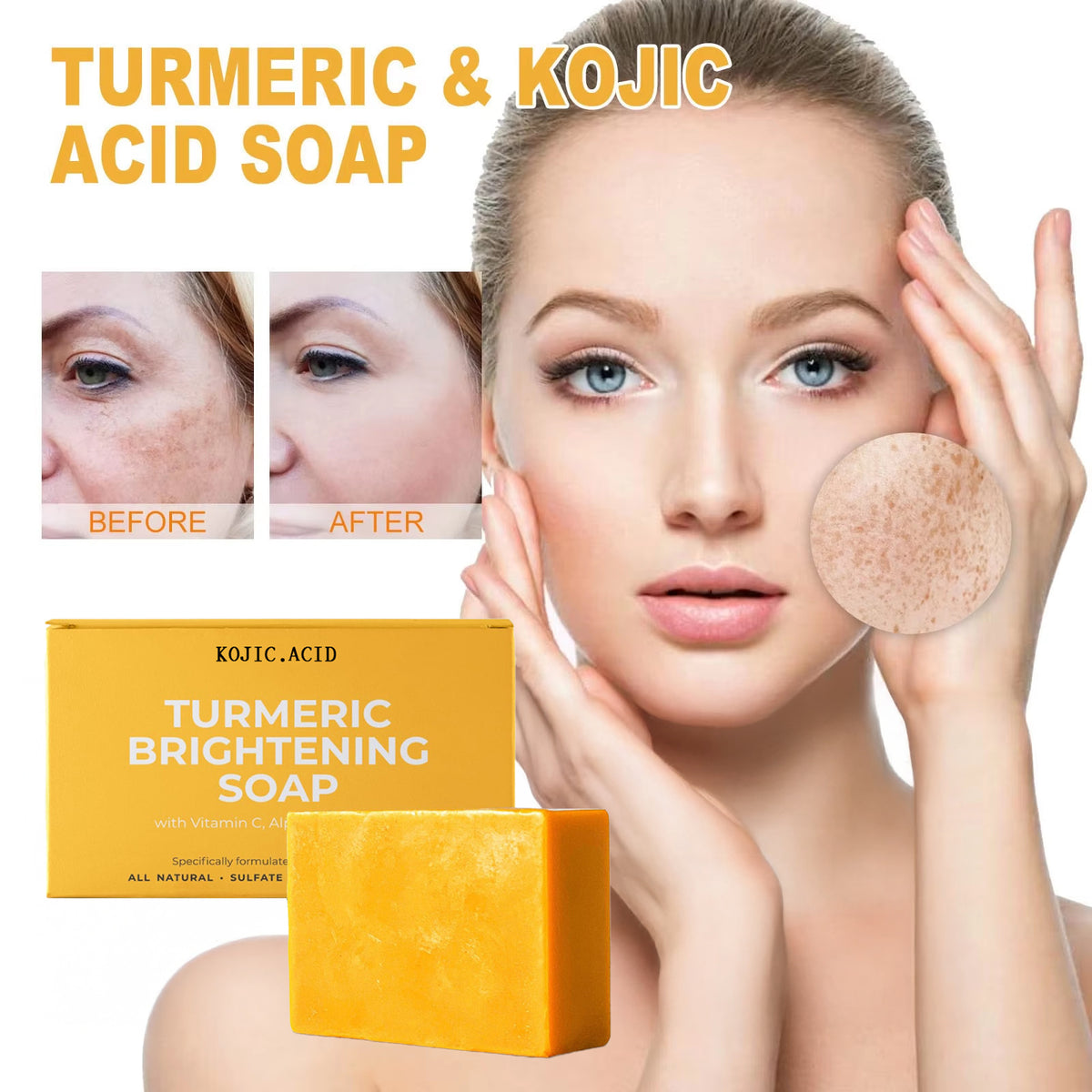 Turmeric Kojic Acid Soap - Brightening Handmade Face & Body Bar